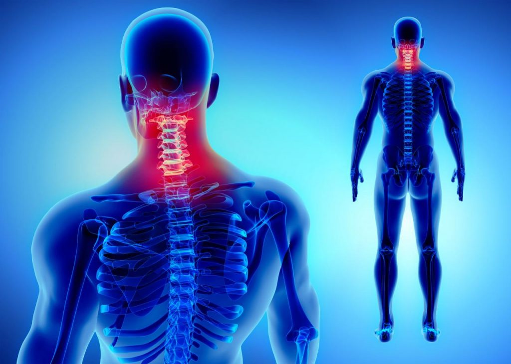 Experiencing Neck Pain? Could it be Cervical Radiculopathy or Myelopathy?