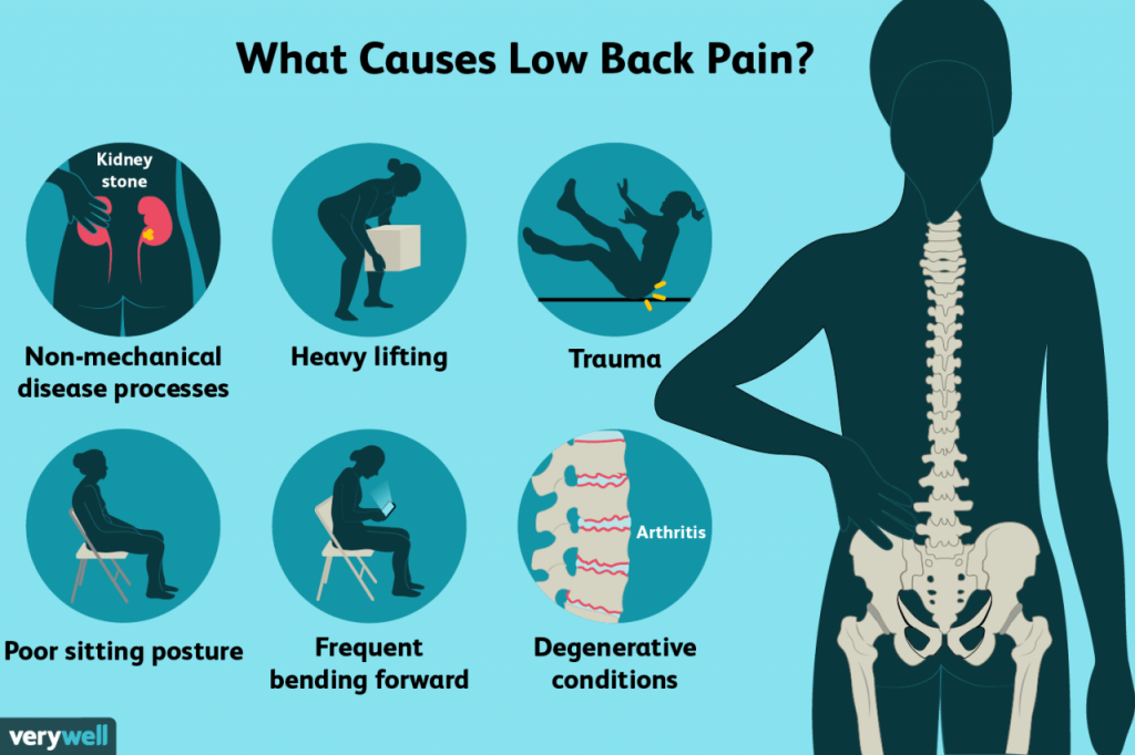 Lower back pain illustration