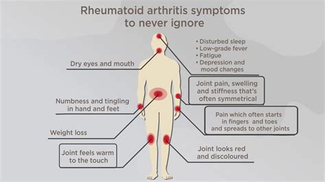 Rheumatic Diseases, Autoimmune Disorders and COVID-19