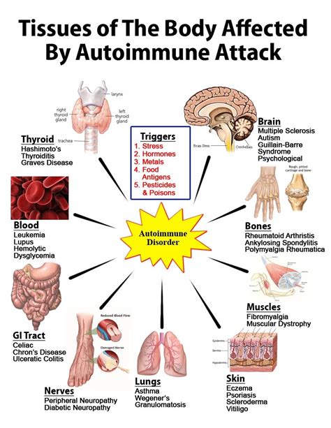 Autoimmune Disorders Image