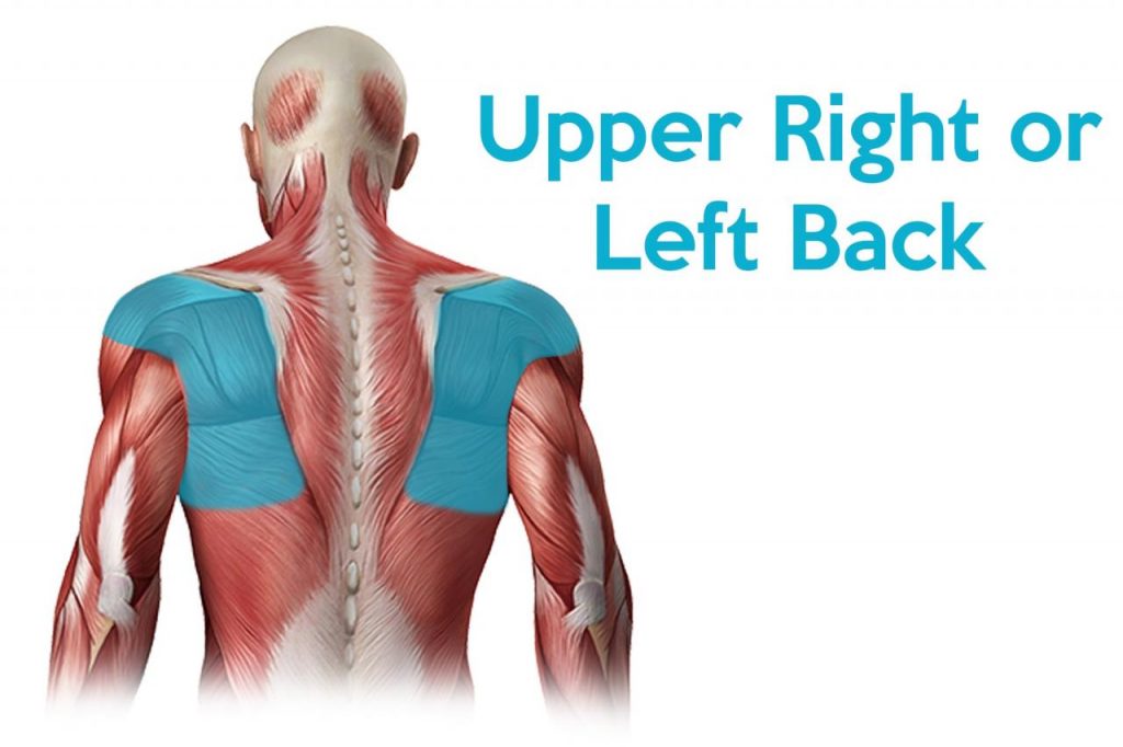 Upper Back Pain Illustration