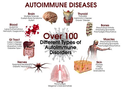 What is Autoimmune Arthritis? Understanding its Types and Symptoms