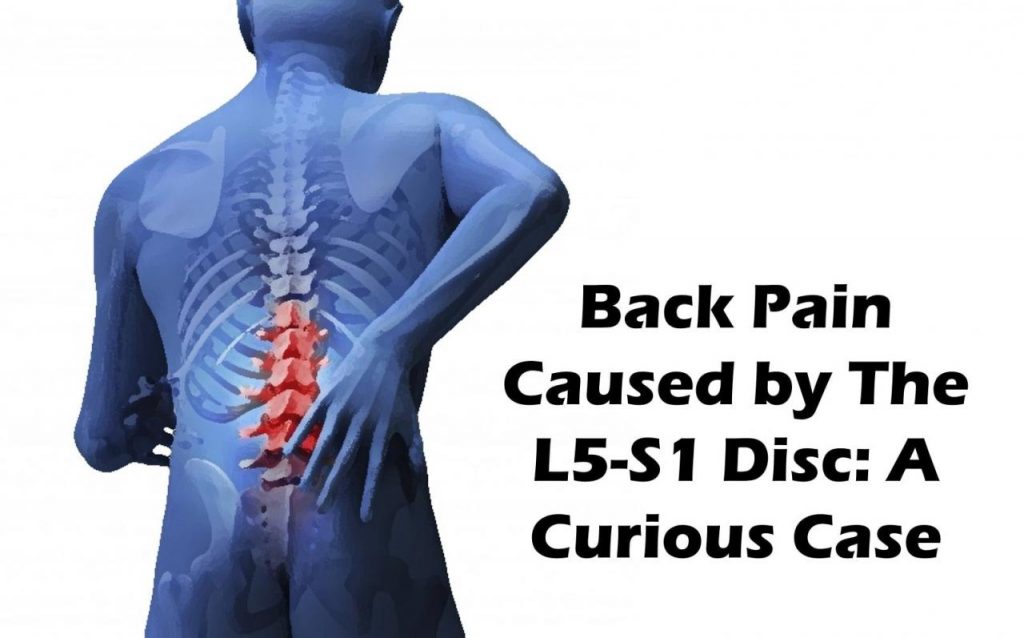 Understanding and Managing Low Back Pain: Causes, Diagnosis, and Treatment