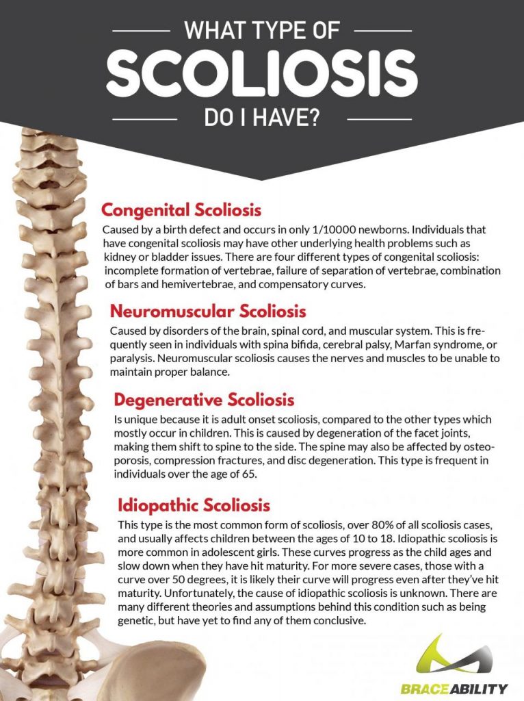 Understanding Different Types of Scoliosis: From Idiopathic to Neuromuscular