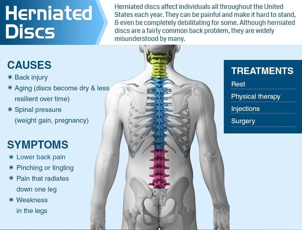 Understanding Herniated Disc Symptoms and Diagnosis: Key Information