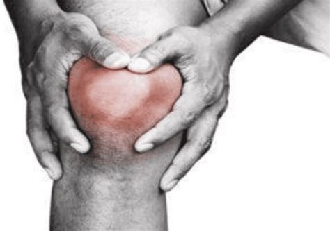 Understanding Knee Rheumatoid Arthritis