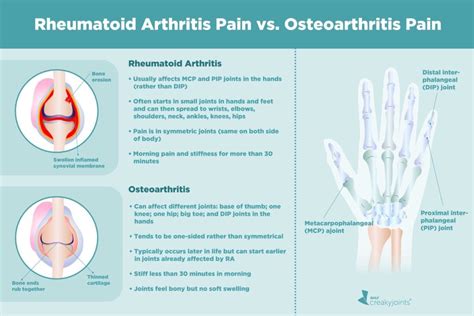 Understanding Rheumatoid Arthritis: Affected Joints and Progression