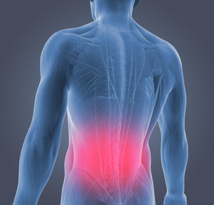 Understanding and Managing Lower Back Pain