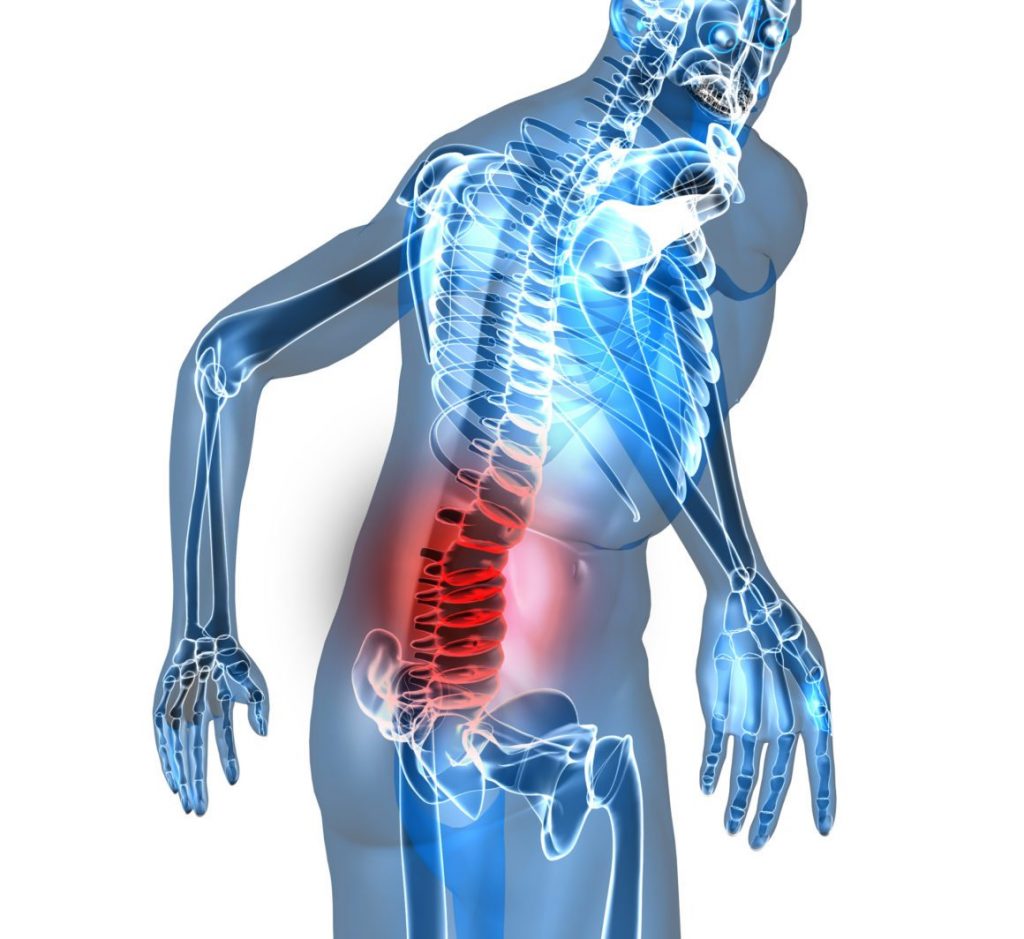 Understanding Lumbar Spondylosis: Symptoms, Causes, and Treatments