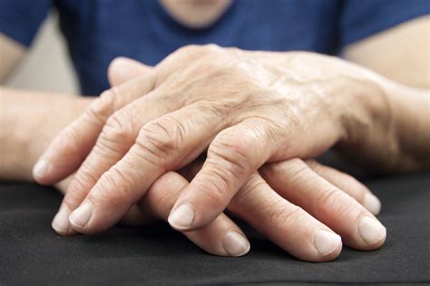 Understanding Rheumatism and Rheumatoid Arthritis