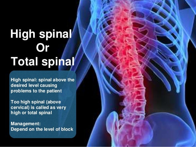 Understanding Spinal Health: Risks, Treatments, and Prevention Strategies