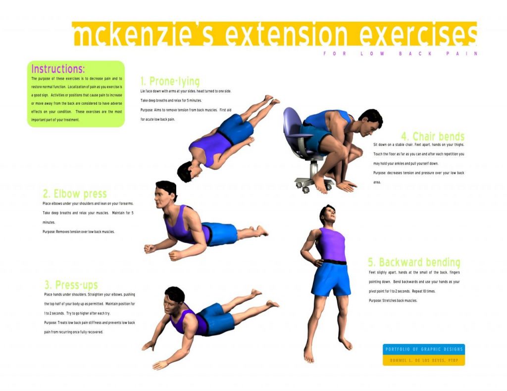 Understanding the McKenzie Back Program: Effective Management for Low Back Pain