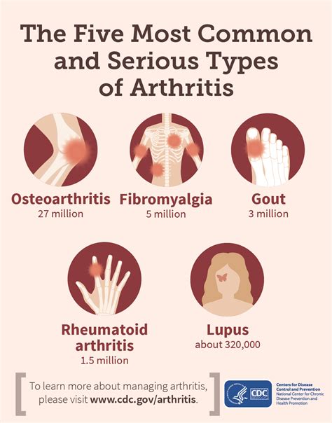 Understanding Inflammatory Arthritis: Types, Symptoms, and Treatments ...
