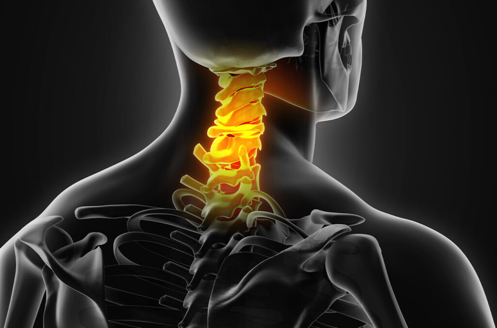 Understanding Neck Pain: Causes, Symptoms, and Treatment Options