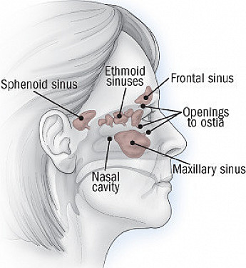 Understanding Sinusitis: Symptoms, Causes, and Treatment Options