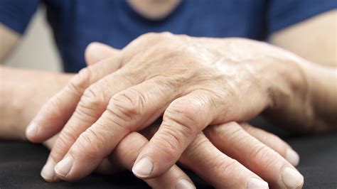 Understanding the Age of Onset for Rheumatoid Arthritis